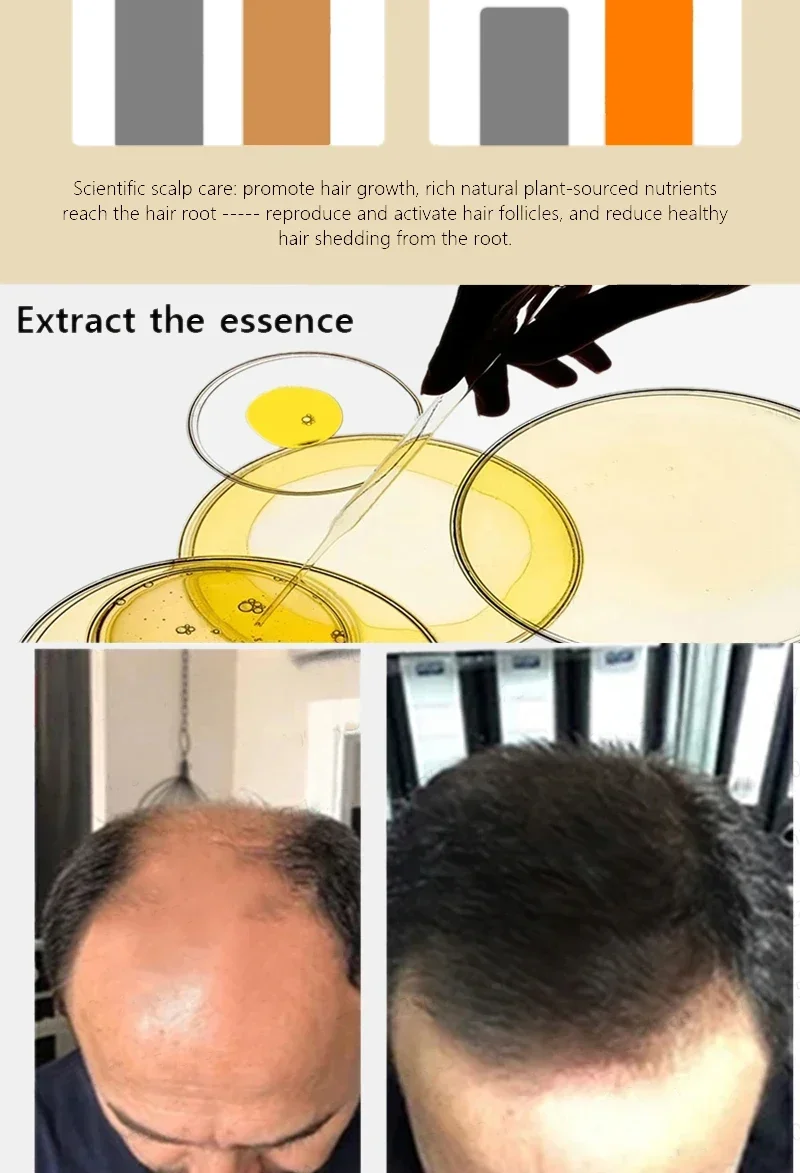 Description Picture 6 of itemBiotin Hair Growth Products for Man Women Anti Hair Loss Ginger Serum Fast Regrowth Oil