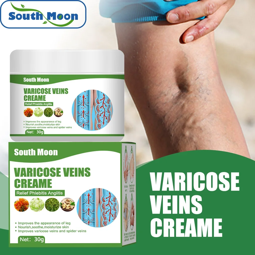 South Moon Varicose Vein Cream Herbal Varicose Veins Treatment