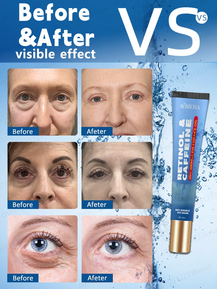 Anti Wrinkle Eye Cream Keep Your Eyes Forever Young anti wrinkle eye cream,eye cream