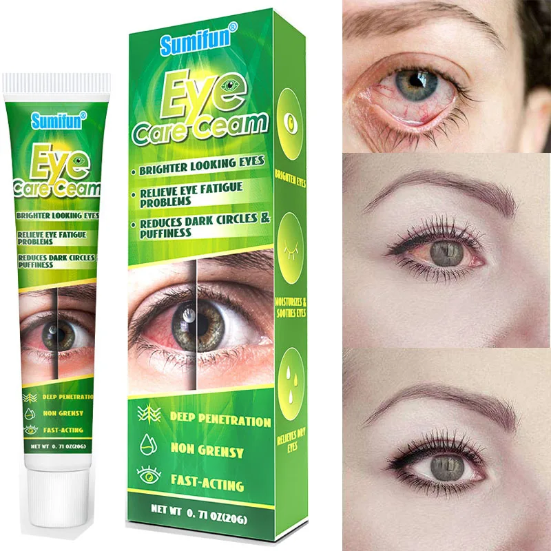 

Chinese Herbal Medicine Eye Care Cream Brighter Looking Eyes Relieve Eye Fatigue Problems Reduces Dark Circles And Puffiness 20g