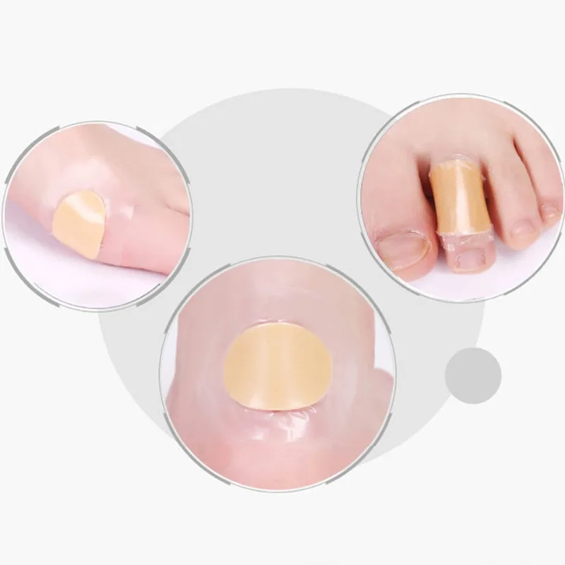 Antiwear Heel Stickers Foot Protecting Wounds Pad Lightweight Portable Waterproof Heel Patch Friction Resistant Foot Protector