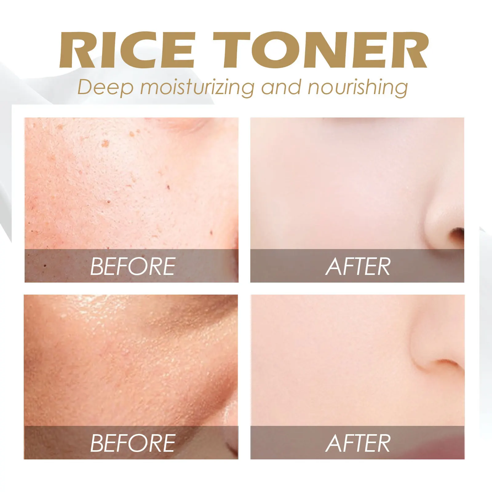 Face Serum Rice Toner Anti Acne Deeply Moisturizing Brightening