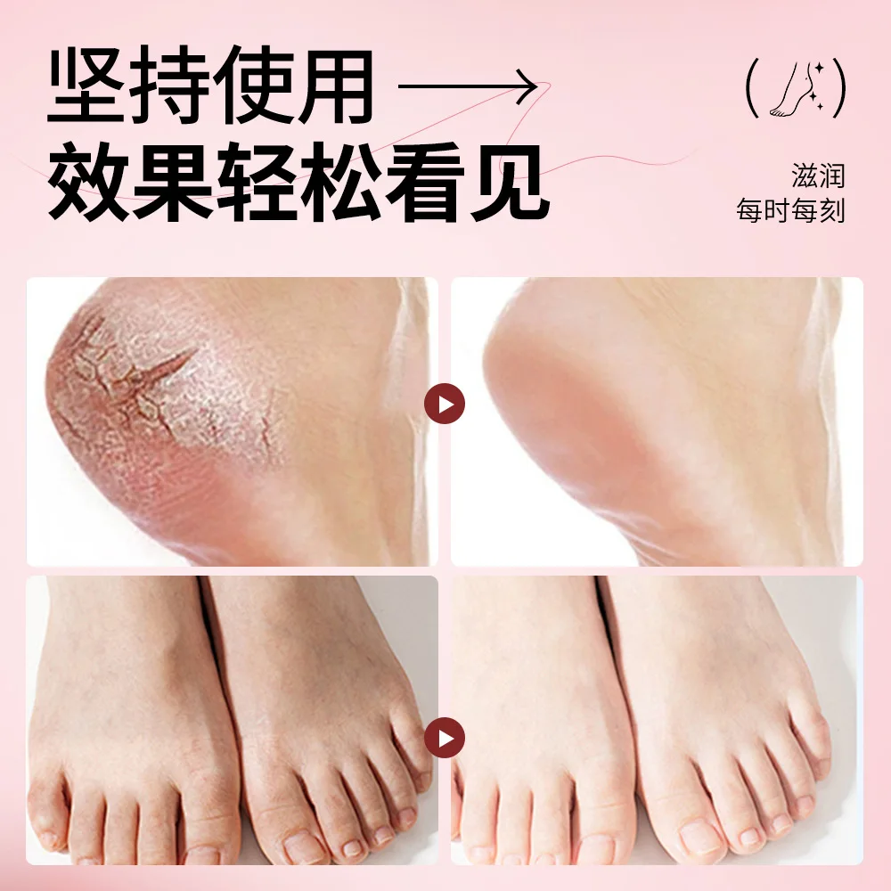 SADOER Mitao Foot Soothing Moisturizing Cream for Smooth, Revitalized Skin