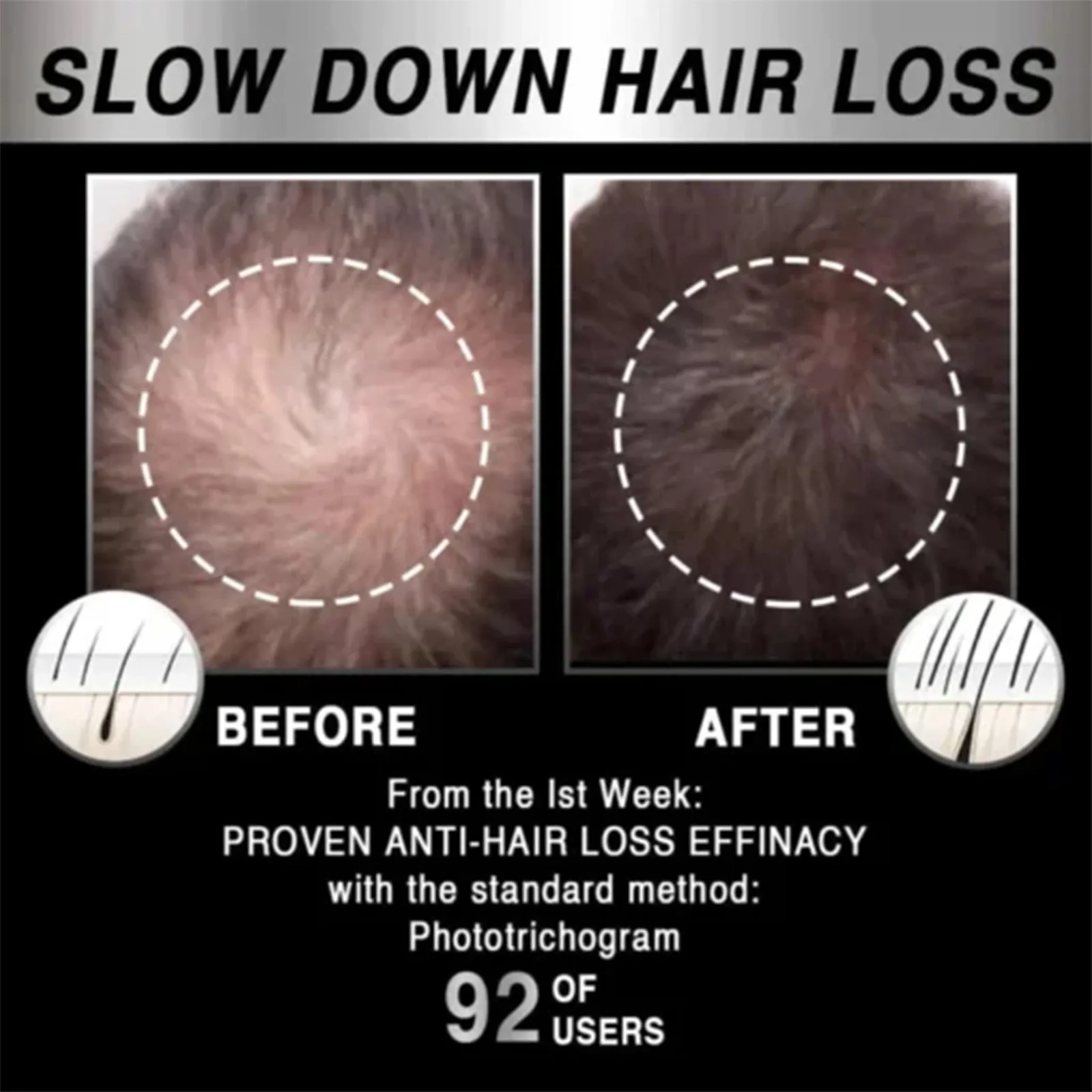 غطاء علاج تساقط الشعر بالأشعة تحت الحمراء