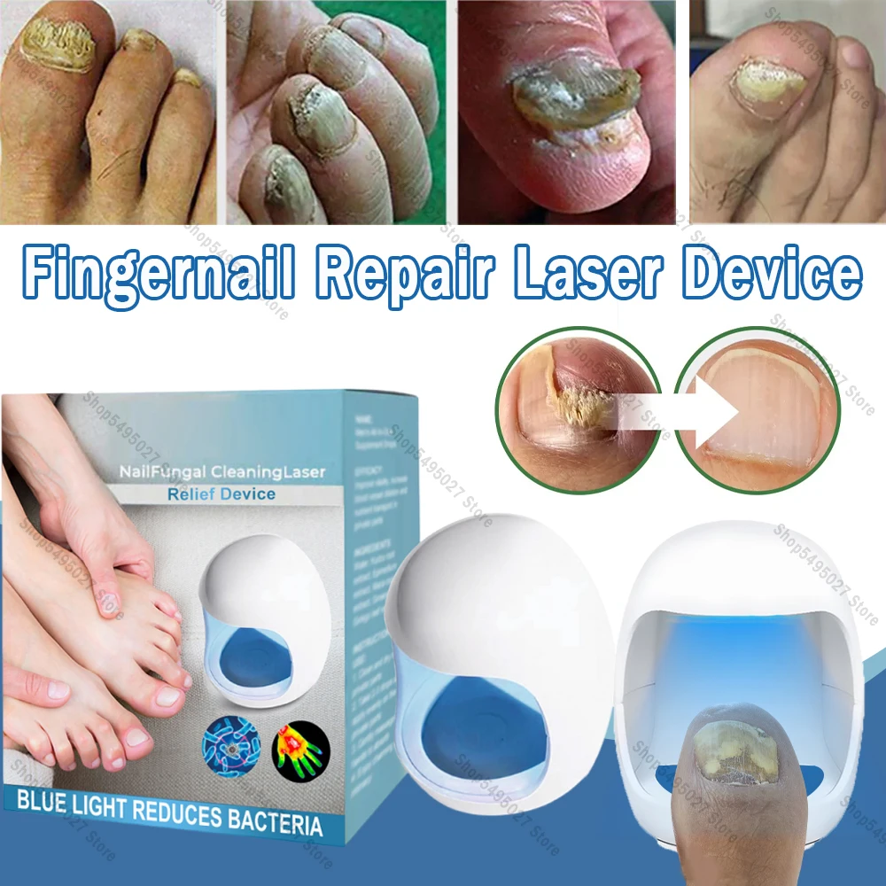 Fingernail Repair Nail Cleaning Laser Device Nail Fungus Treatment Cold Laser Therapy Physical