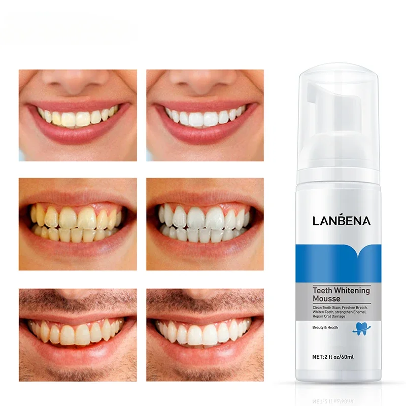 

LANBENA 60ml Teeth Whitening Mousse Remove Yellow Plaque Smoke Stains Oral Hygiene Toothpaste Dental Cleaning Fresh Breath Tool