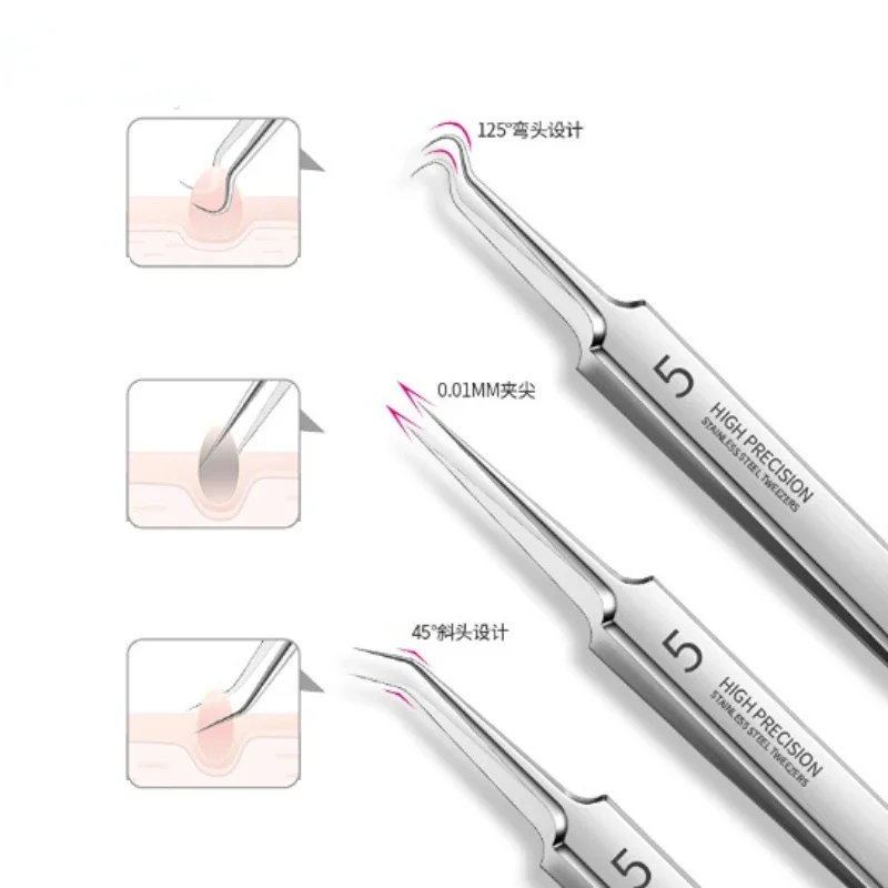 Pimples Blackhead Tweezers Tweezer Tool Blackhead Clip Tweezers German No. 5