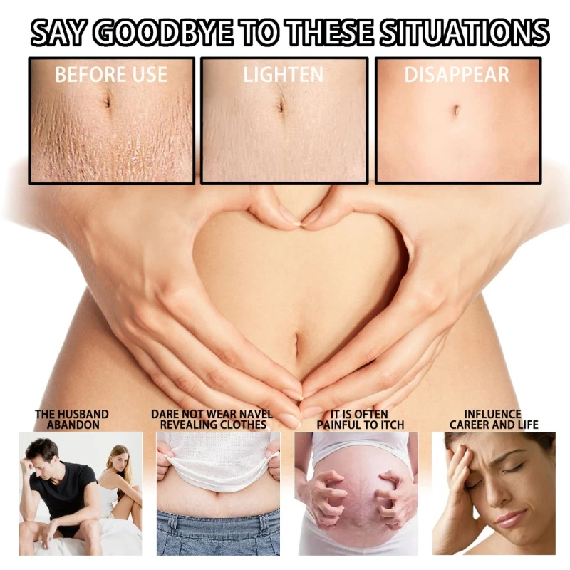 Рисунок 3 - Крем для удаления растяжек