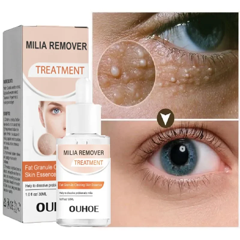 Fat Granules Removal Eye Serum Fade Fine Line Dark Circle Bag Anti-Puffiness Firming Anti Wrinkles Moisturize Skin Care Products fat granules removal eye serum eye skin barrier repair treat products fade dark circle eye bags anti puffiness korean skin care