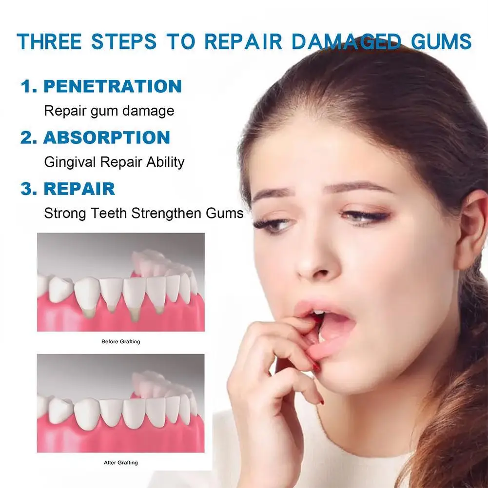 30ml Gum Repair Regrowth Drops Gum Restore Liquid Drops Advanced, Gum Restore Plus Liquid Drops Rejuvenate Gum Natural Oral Care