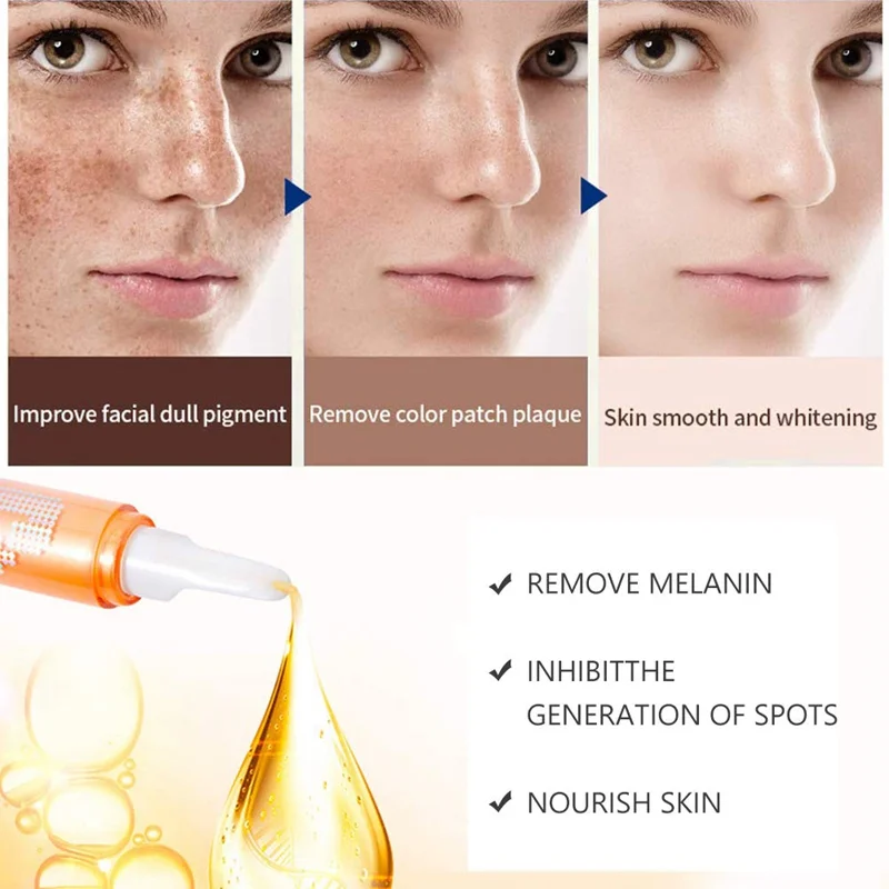 Instant Spot Gel VC Whitening Spot Serum Remove Melanin Melasma Brightening Intensive Whitening Cream Beauty Health
