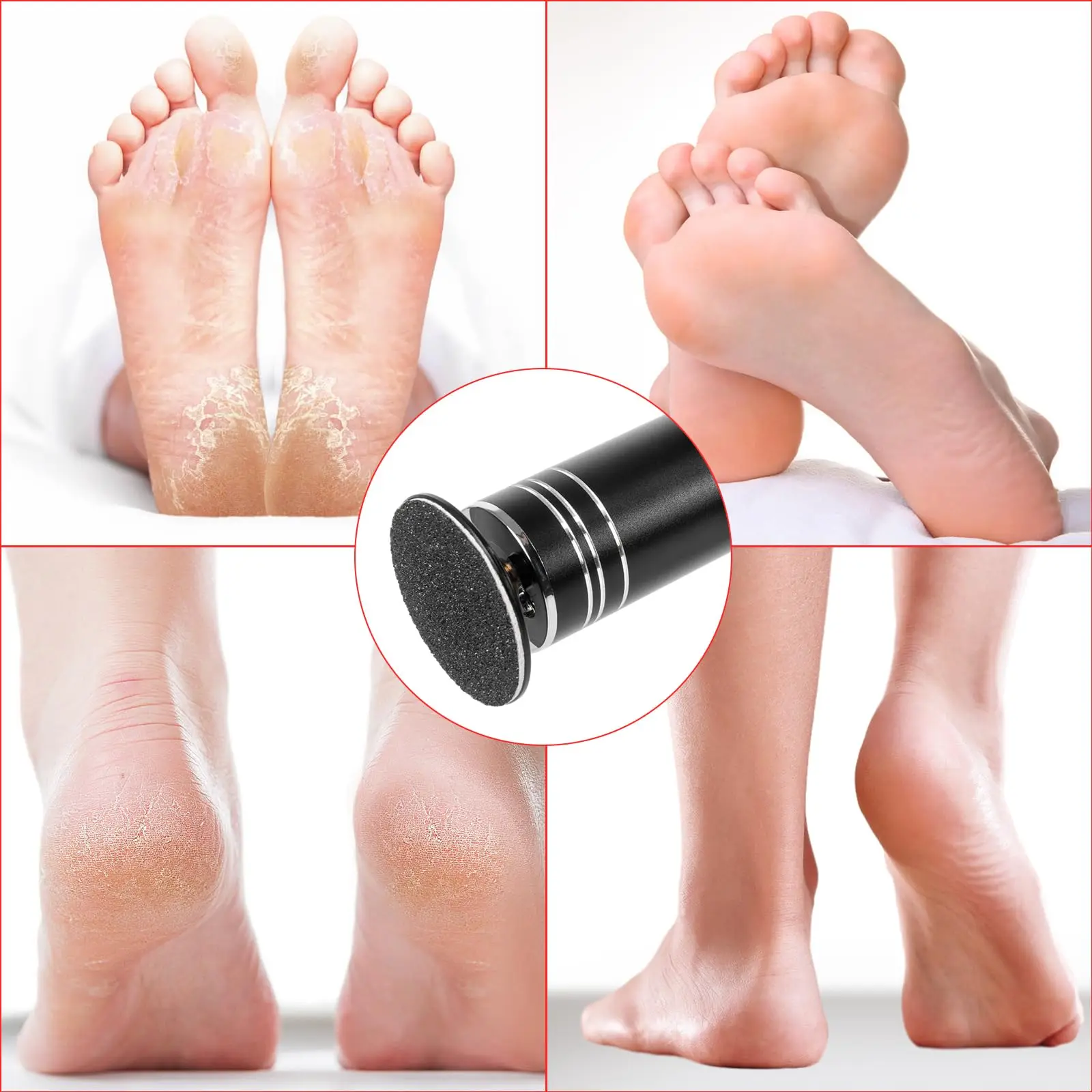 Electric Callus Remover With Speed Controller And 60 Sandpaper Discs_voghion.com