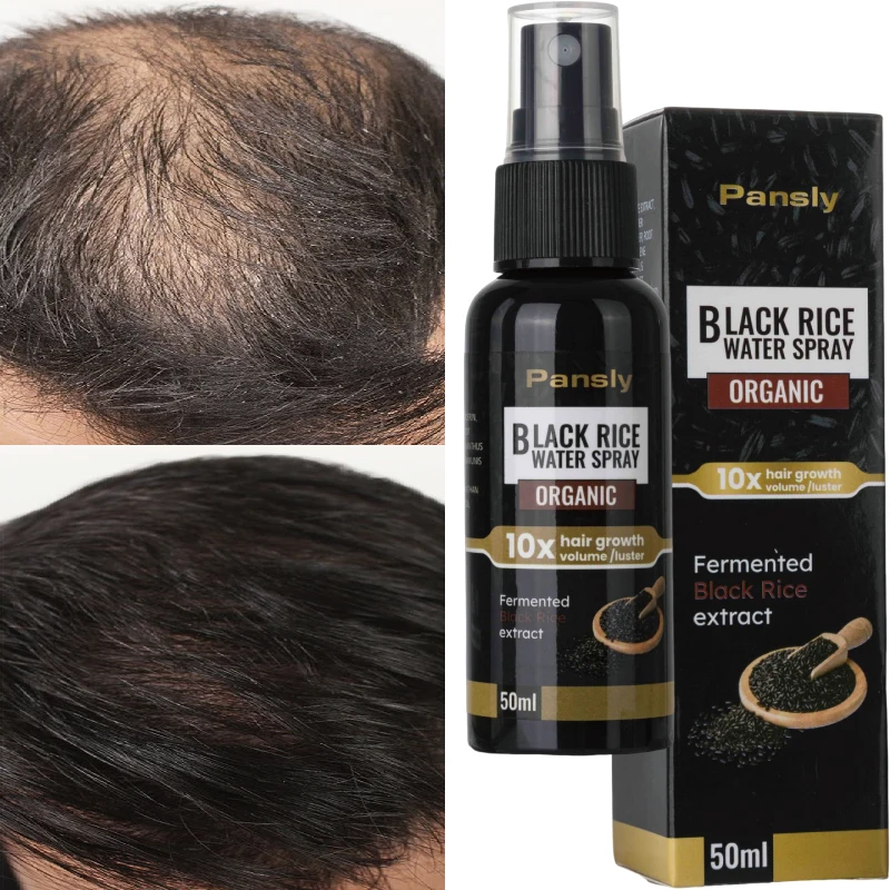 

Black Rice Hair Spray Products Fluffy Straight Fast Growth Hair Care Essential Oil Anti-Hair Loss Spray Scalp Care Men And Women