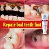 New Upgrade Quick Repair of Cavities Caries Removal of Plaque Stains Decay Whitening Yellowing Repair Teeth Teeth Whitening 3