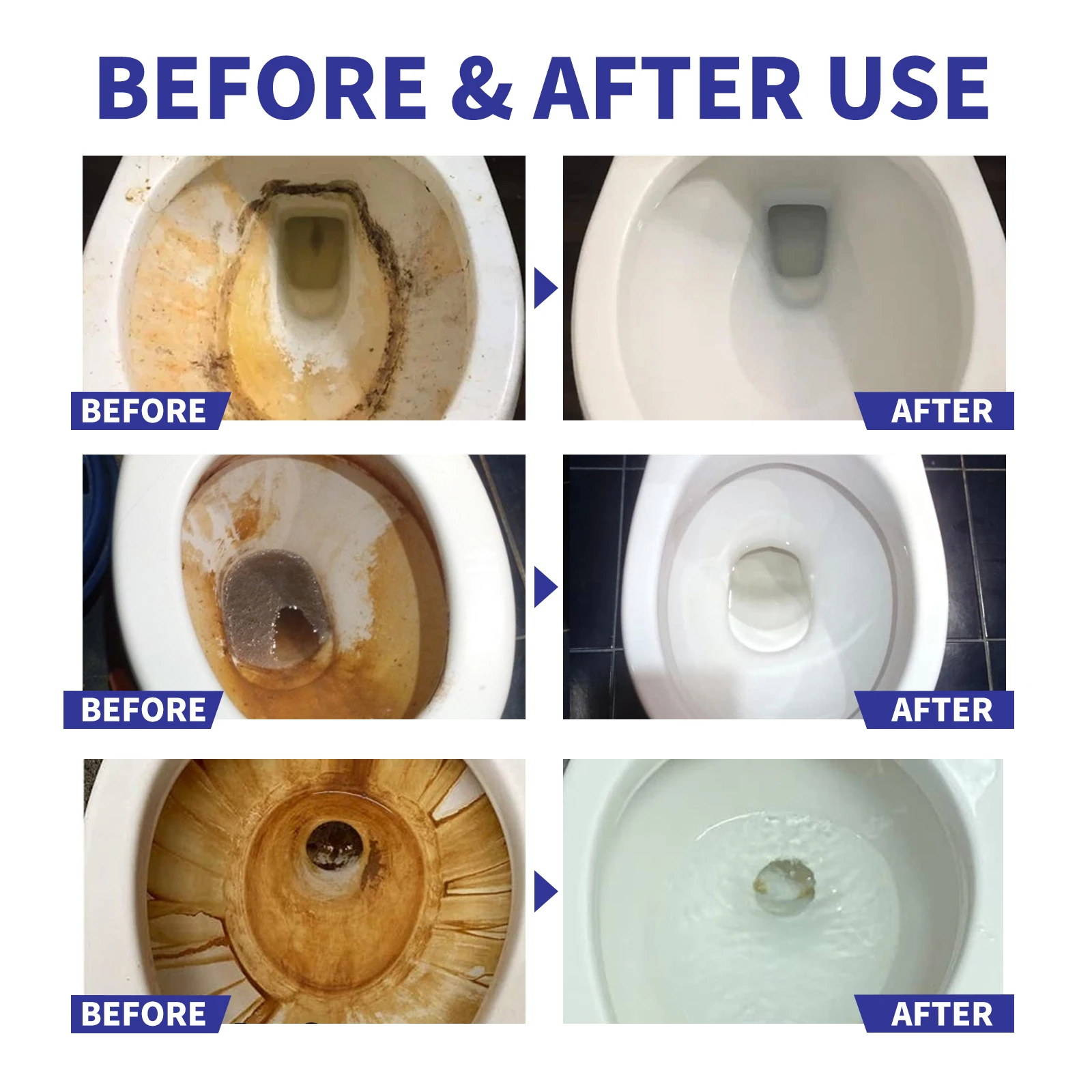 Jaysuing Toilet bowl cleaner Cleaning toilet bowl urine stains dirt deodorization household toilet cleaner