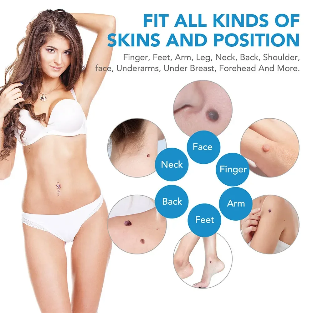 Auto Micro Skin Tag Remover Device 2 in 1 For Adult Mole Wart Remover