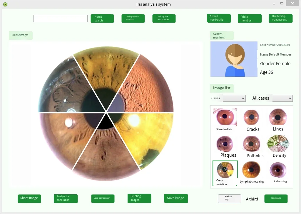 Iridologianalysator