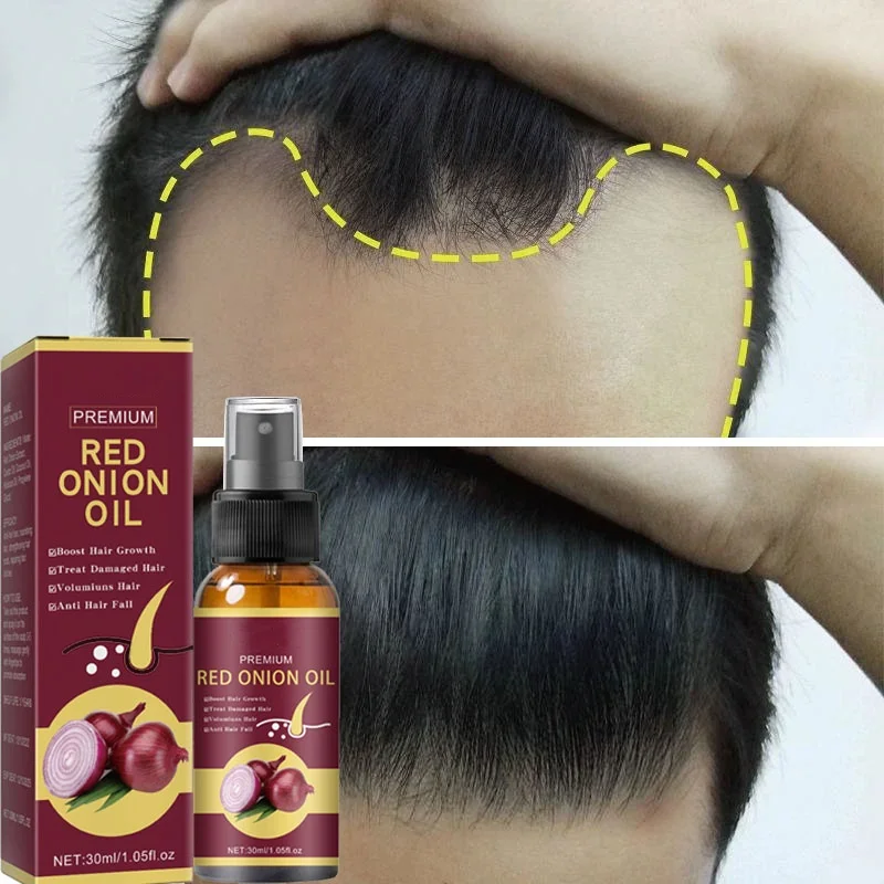 Hair Growth Serum Spray Repair Hair Nourish Root Regrowth Hair Anti Hair Loss Powerful Treatment Essence For Men Women Hair Care