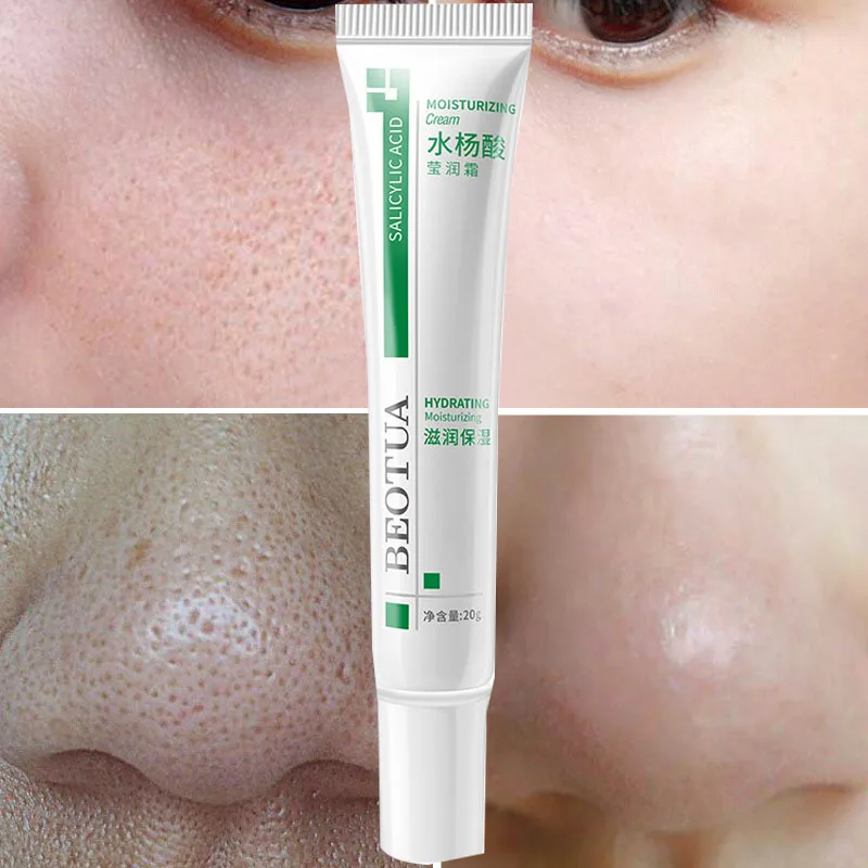 Salicylic Acid Shrink Pores Face Cream Acne Fruit Acid Serum Treatment