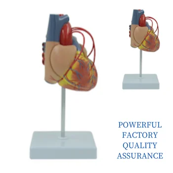 Coronary Bypass Heart Model 1