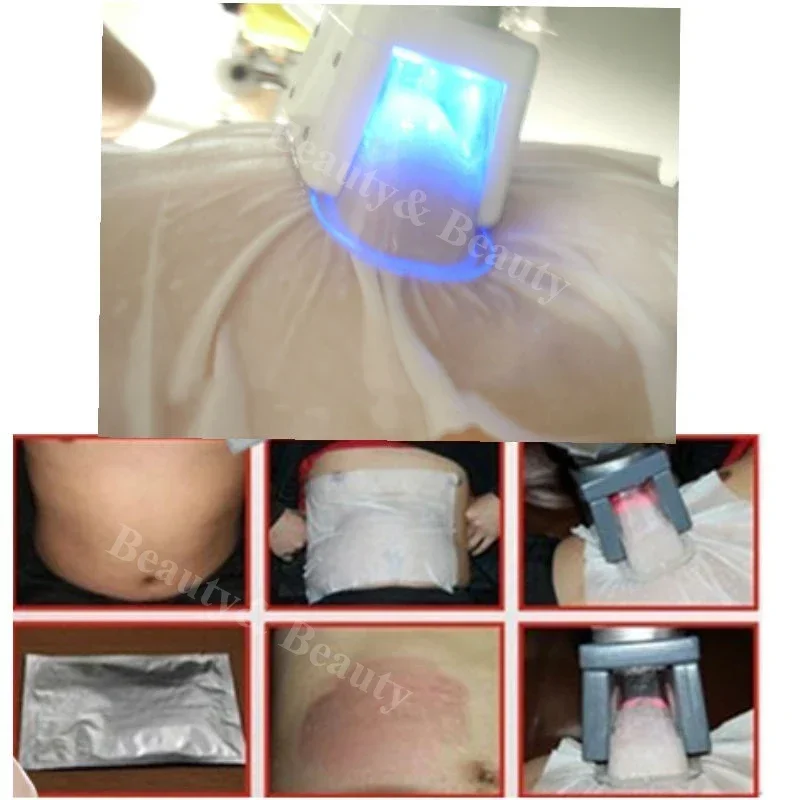 Anti Freeze Membrane Antifreeze Film Gel Paster Cryotherapy Liposuction Cooling Cryo Lipo Weight Loss Slimming Cellulite Pad slimming patch slimming cream gel