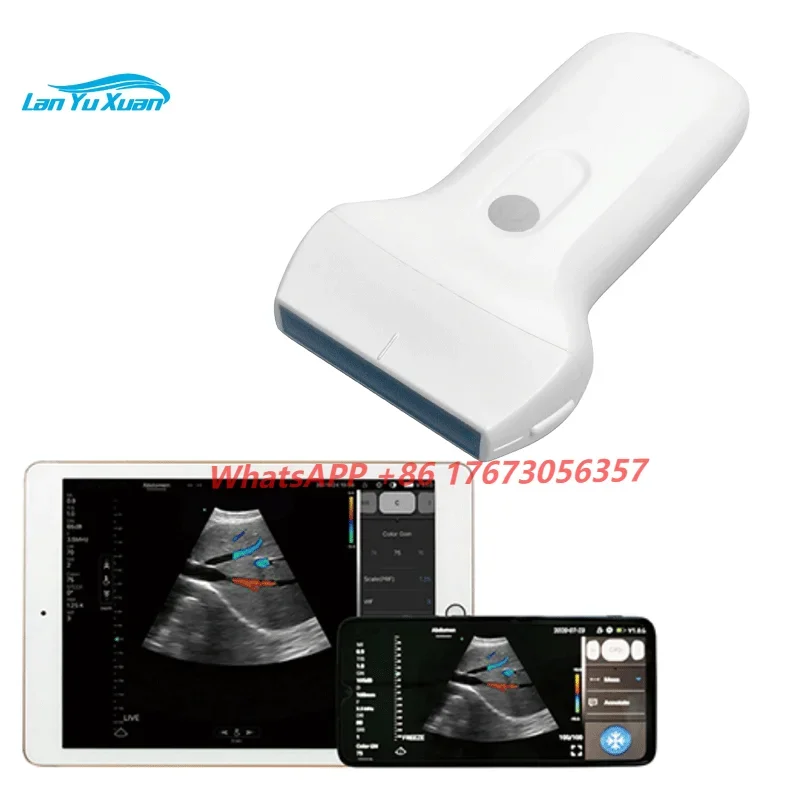 

USB & WIFI Portable Handheld Color Doppler Android Wireless Ultrasound Probe