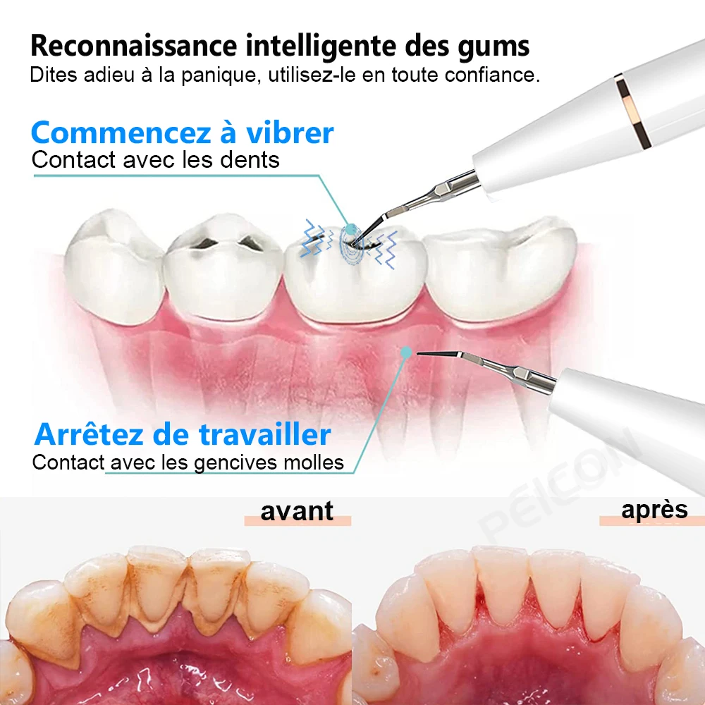 Melodii - Nettoyeur de dents à ultrasons ultime UV-C et 45 kHz : économe en  énergie