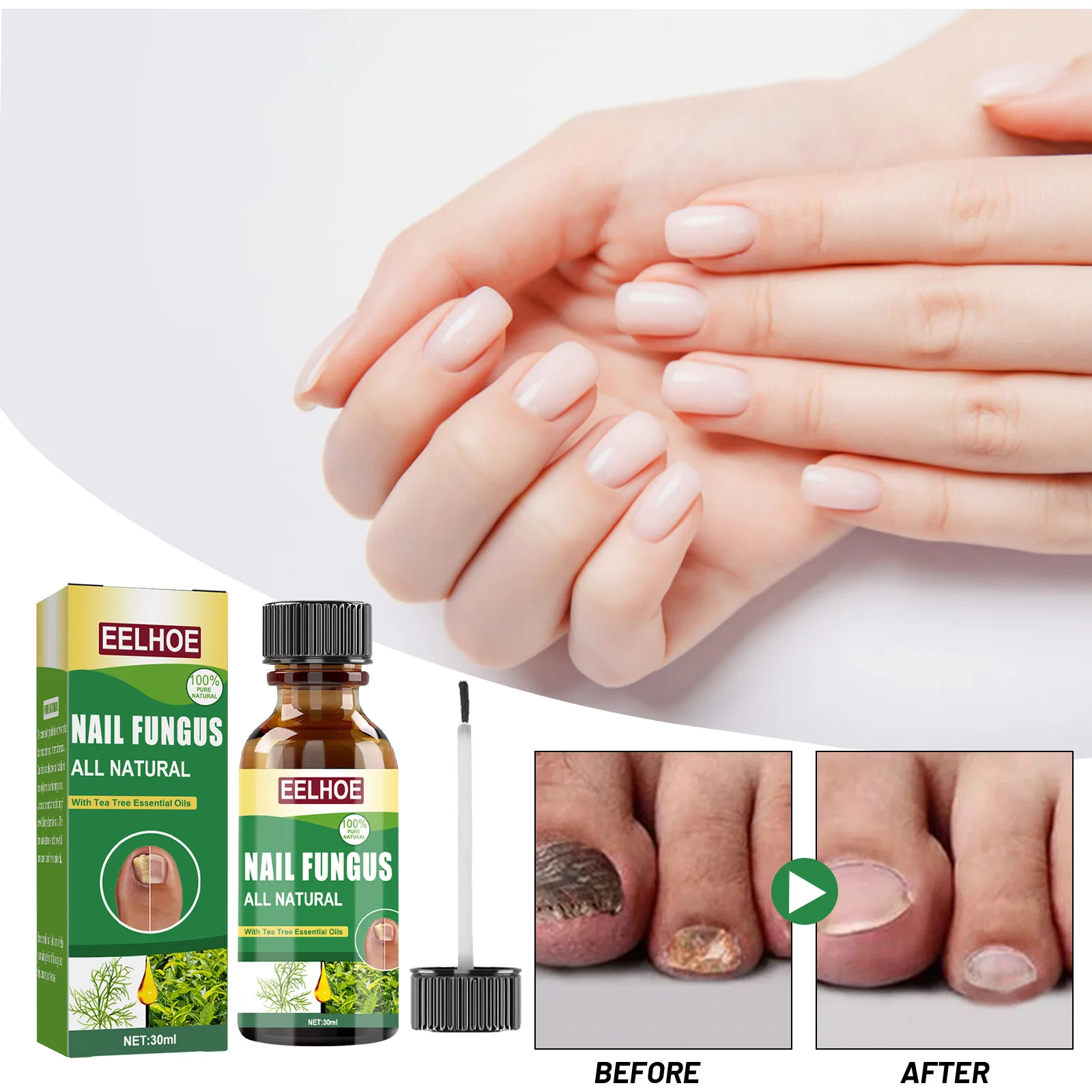 

Nail Fungus Care Liquid Tea Tree Oil for Nail Treatment Onychomycosis Antibacterial Paronychia Repair Damaged Toenail Cuticles