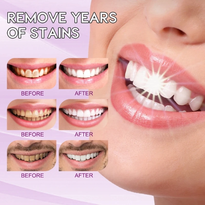 Toothpaste Whitening Teeth Whitening Tooth Stain Removal Teeth Booster Whitener