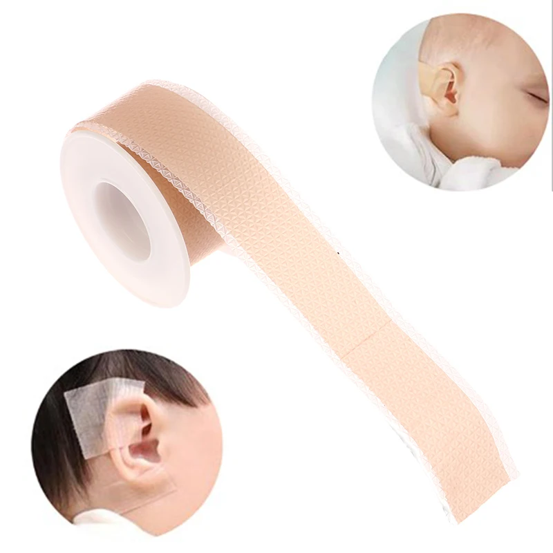 4cm*50cm Correcteur Esthétique d'Oreille de Bébé en Silicone Correcteur  pour oreille saillante Patch d'oreille en sailli ZR004