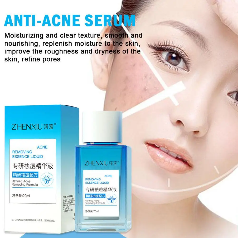 20ML Acne Removal Serum Treatment Acne Pimples Pore Oil Facial Skin Shrinking Smooth Repair Control Anti-acne Cleaning Care H2J5