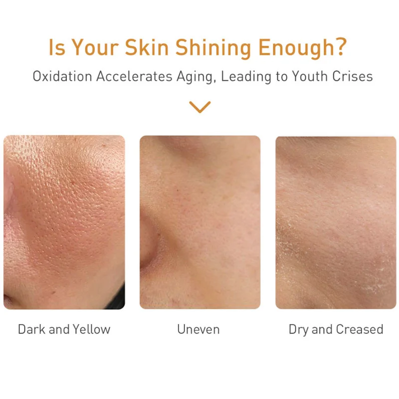 Vitamin C Whiten Serum Brighten Anti-Freckles Remove Melanin Wrinkles Reduce Pigmentation Moisturizing Smooth Skin Care_voghion.com