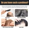 Hair Loss Treatment Shampoo Promote Growth Strengthen Hair Roots Scalp Repair Anti Thinning Moisturizing Thickening Hair Care 6