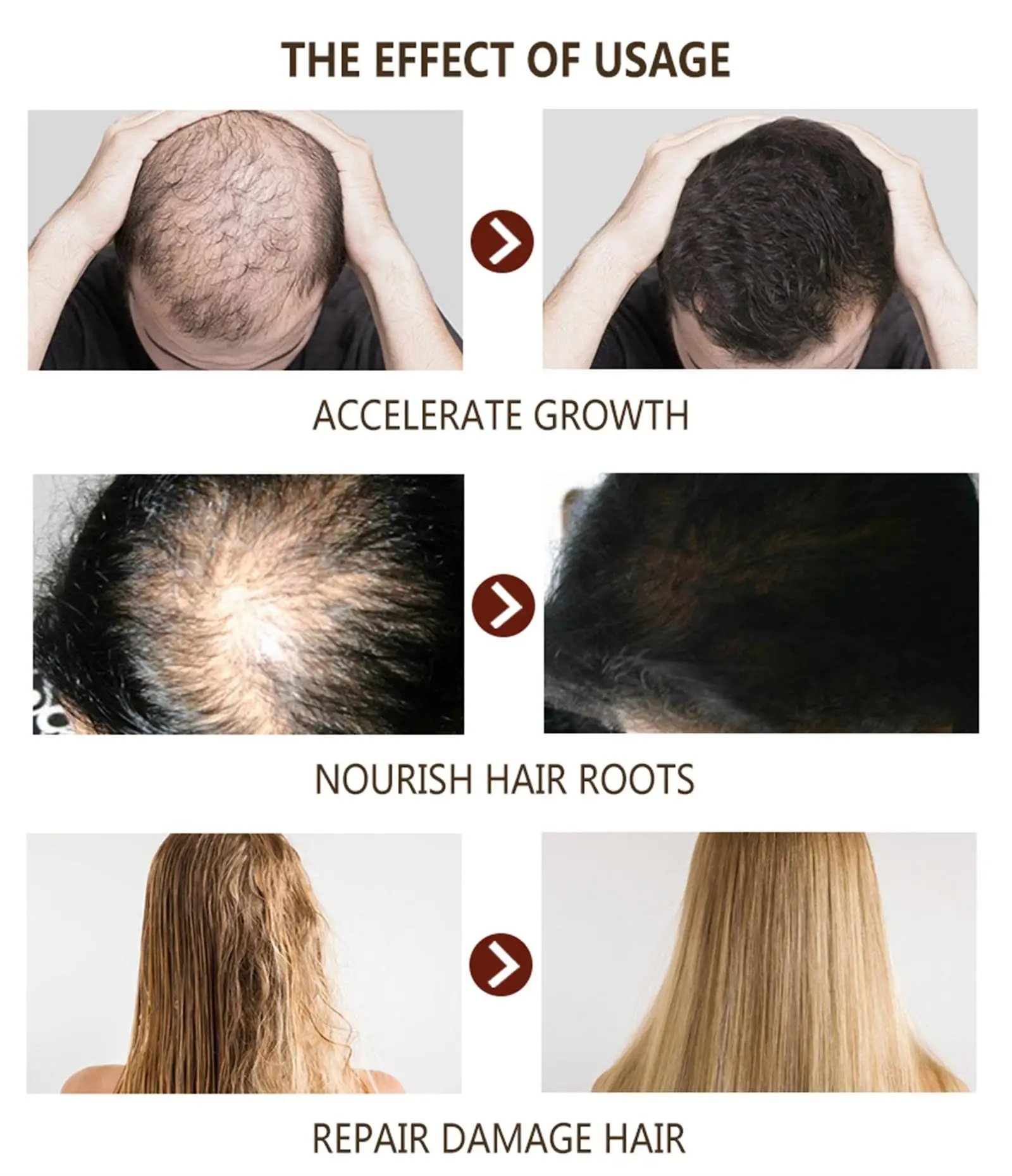 Description Picture 6 of itemPowerful Hair Growth Serum Spray Natural Anti Hair Loss Products Repair Nourish Hair Roots Fast Regrowth Hair Care Men Women
