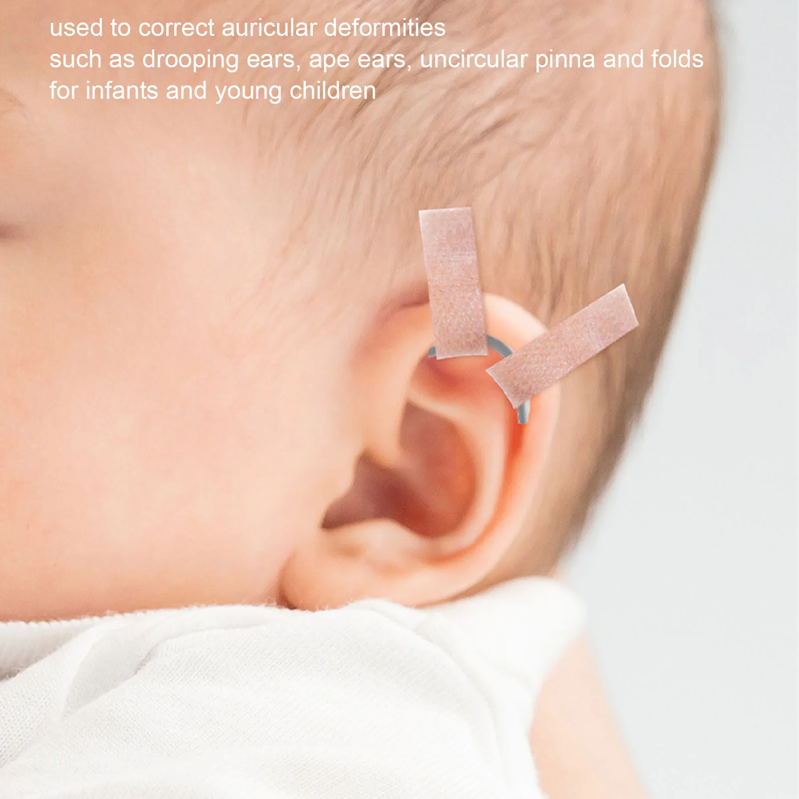 Ear Corrector Baby Gel Ear Tape Auricle Malformation Prevention