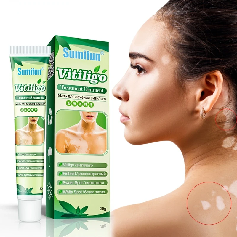 

1Box Sumifun New Vitiligo Treatment Ointment Leukoplakia Disease White Spot Skin Repair Cream Pigment Melanin Medical Plaster