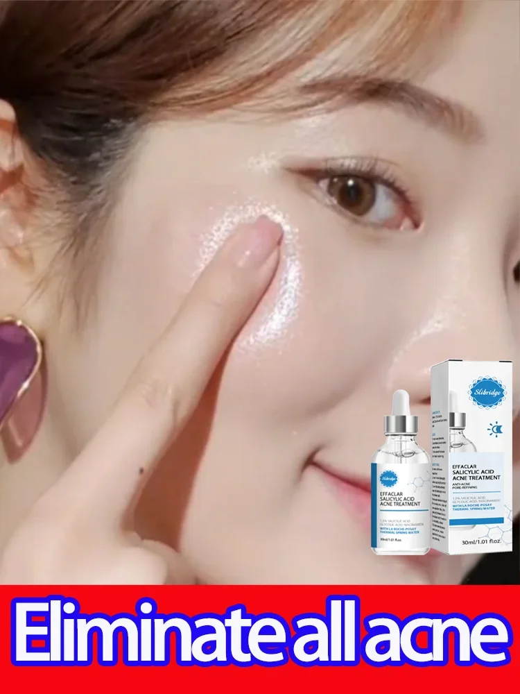 

Acne Cream Remover Face Marks Pimple Serum