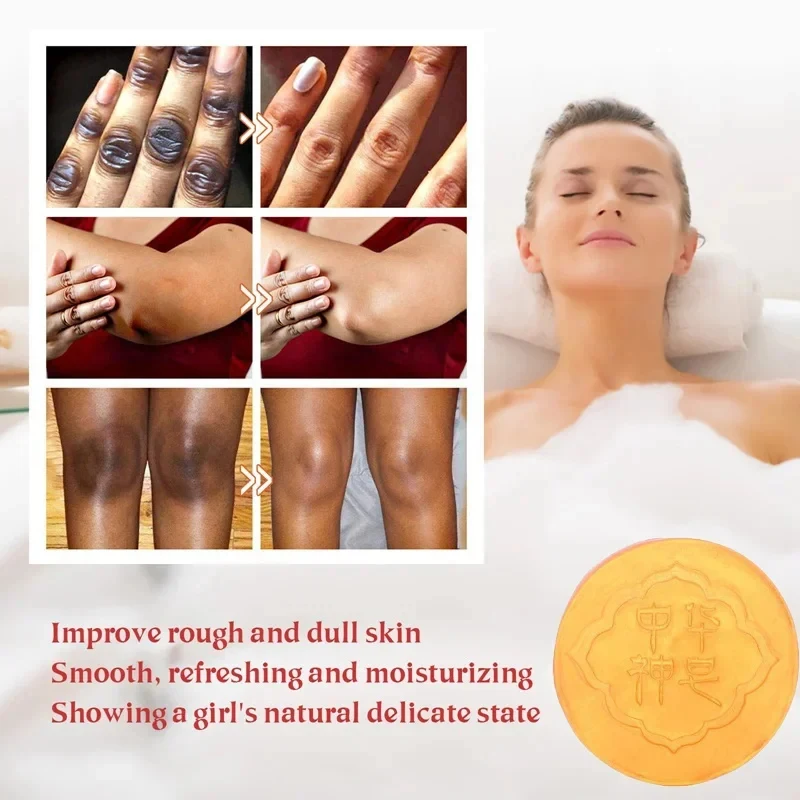 Body Whitening Soap Deep Clean Skin Chicken Skin Removal Soap Armpit Underarm Knees Bleaching Body Brighten White Care New 6