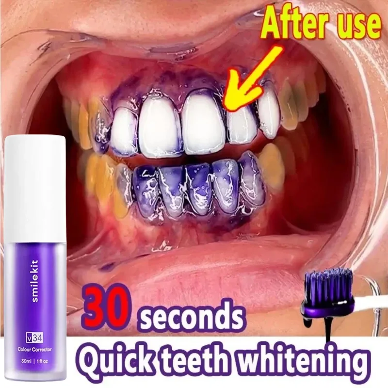 V34 Purple Whitening Tandpasta Verwijderen Tandvlekken Repareren Zorgzame Tanden Orthodontische Tandpasta Verse Adem Tand Zorg Nieuw