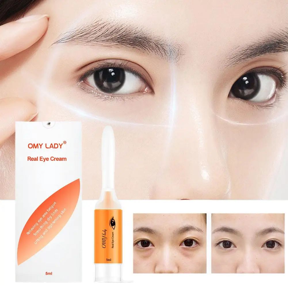 

Omy Lady Eye Cream Anti Wrinkle Age Instant Remove Firming Eyebags Eye 5ml Circles Puffiness Care Dark Anti Under Y1s5