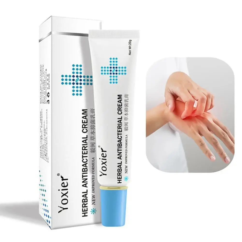 20g Psoriasis Skin Care Ointment Itching Cream Antibacterial Pruritus Anti-Itch Desquamation Treatment