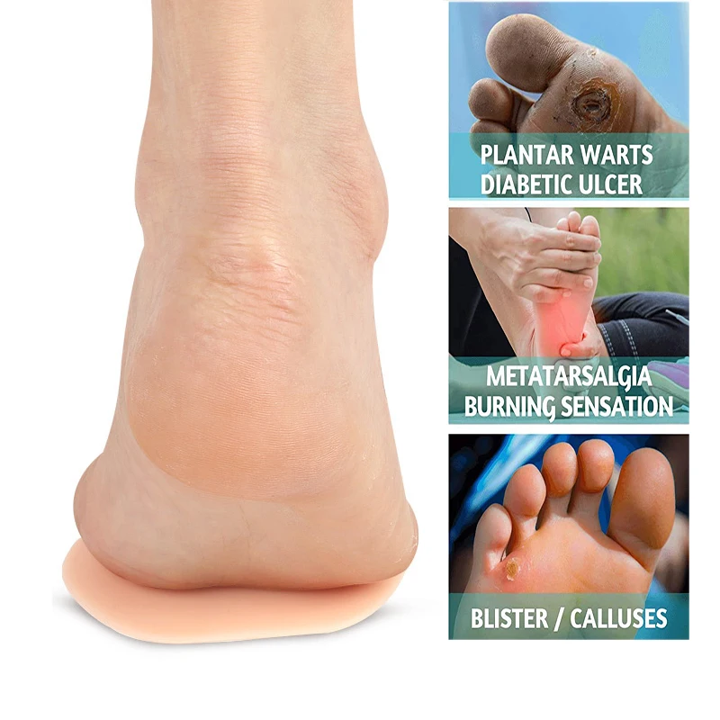 Pexmen 2Pcs/Pair Gel Forefoot Pad Ball of Foot Cushions Metatarsal