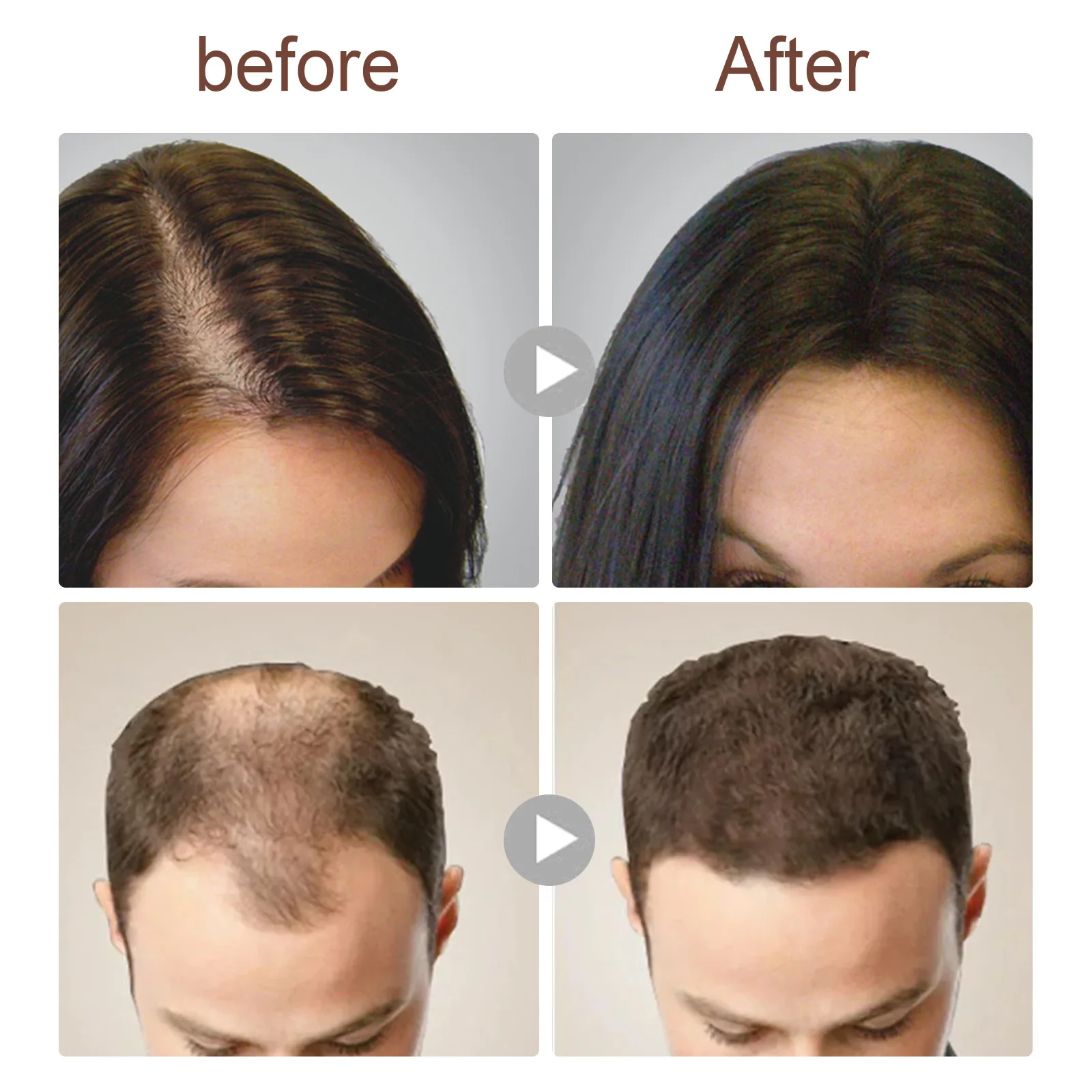 Description Picture 6 of itemAnti Dropping, Nourishing, Firming,For the sake of hair , Protecting the scalp.Protecting the scalp and Nourishing Hair Roots
