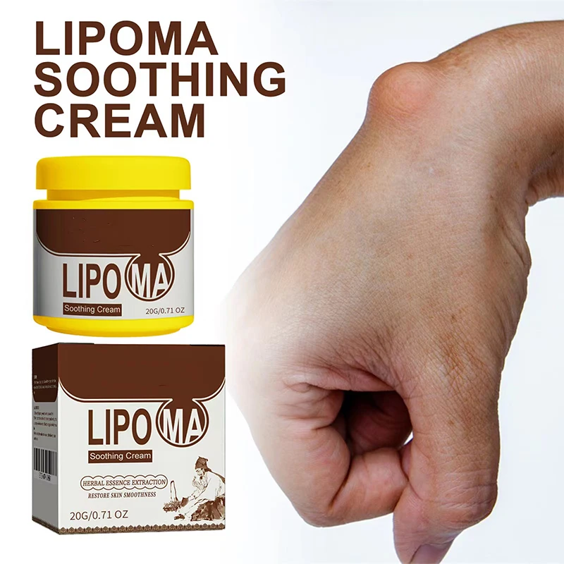Soothing Cream Subcutaneous Lumps Remover cream lumps remover