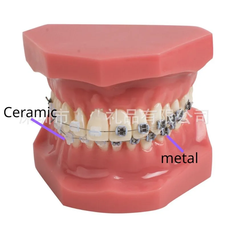 

Human Teeth Dental Orthodontic Model Half Ceramic Half Metal Bracket