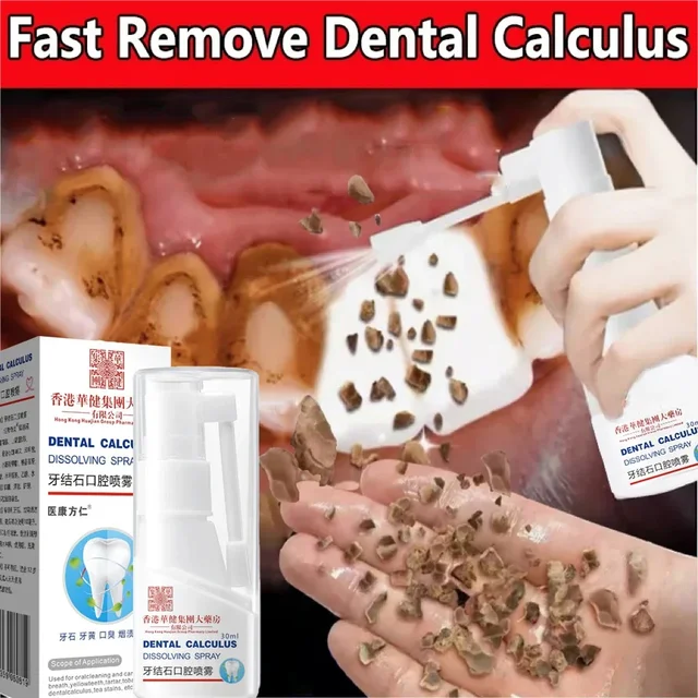 Tooth stone remover,tooth whitening agent,spray,toothpaste book,oral hygiene,halitosis removal,SAF plaque,breath freshening care 2