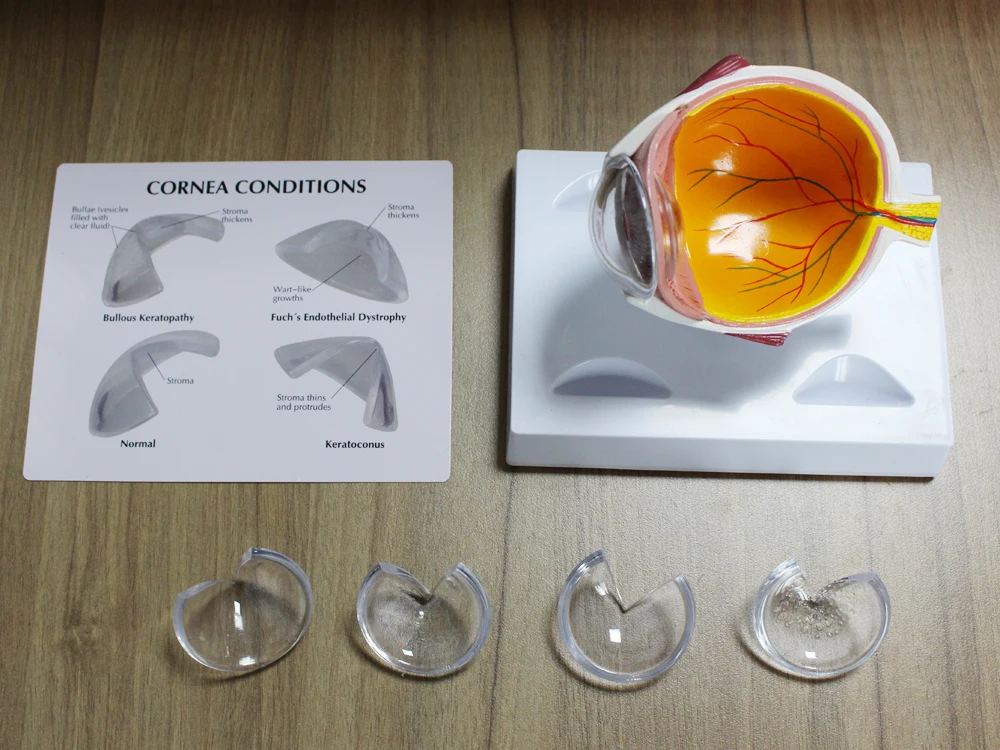 Cornea Eyeball Model Human Eye Demonstration Glaucoma Cataract Anatomy Medical Teaching Tool
