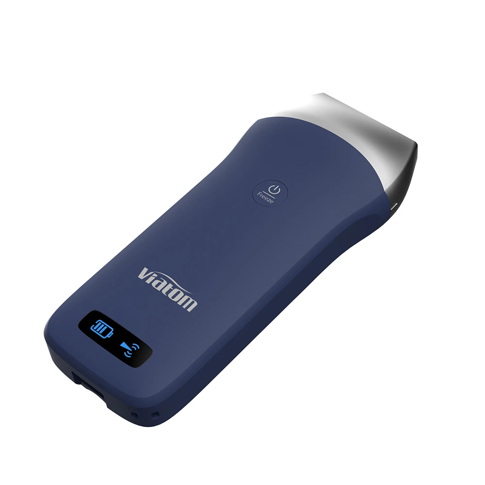 Scanner à Ultrasons Portable Sonostar - Sonde Sans Fil, Compatible IOS, Android, Windows