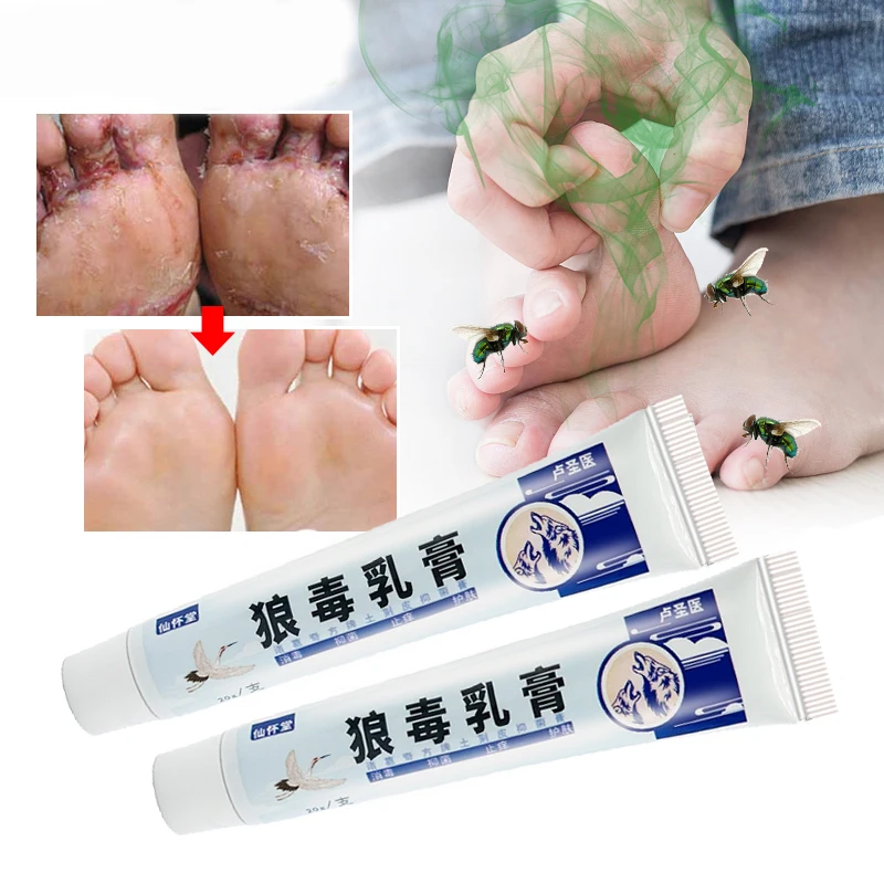 

20g Foot Odor Ointment Foot Peeling Treat Dressing Tinea Pedis Repair Fungus Inhibitor Antipruritic Care Remove Beriberi Cream