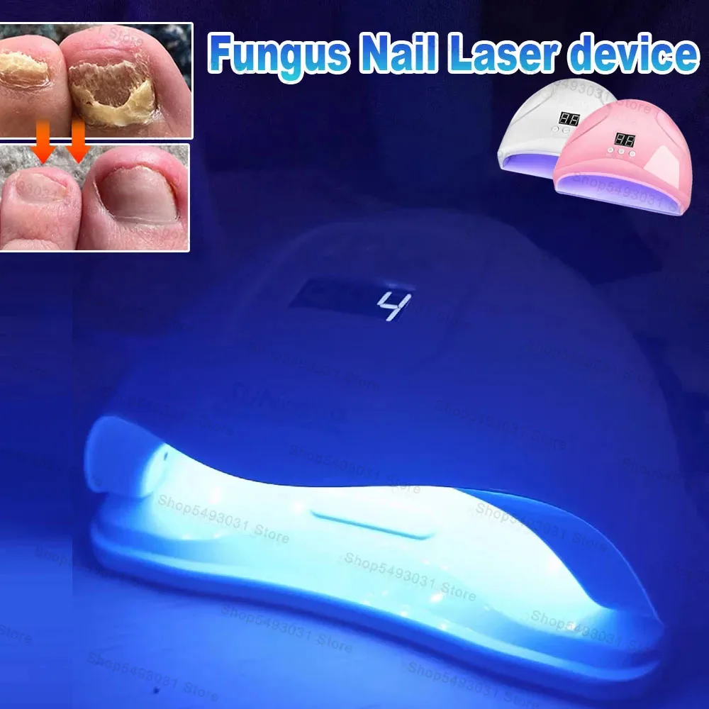 FungalNailDeviceRepairFastNailsFungusOnychomycosisRepair